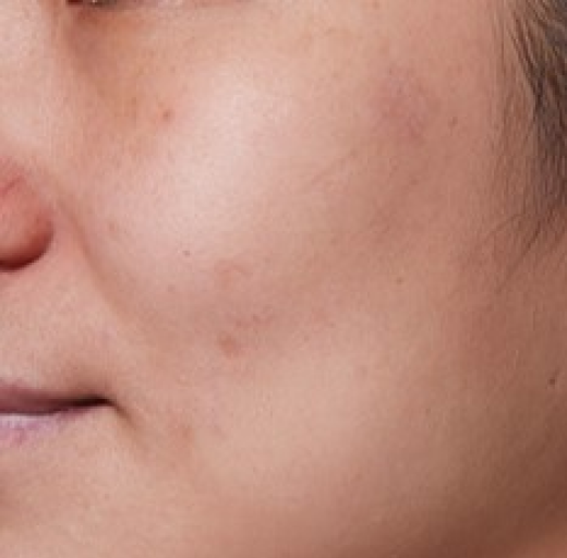 Before/After Image
